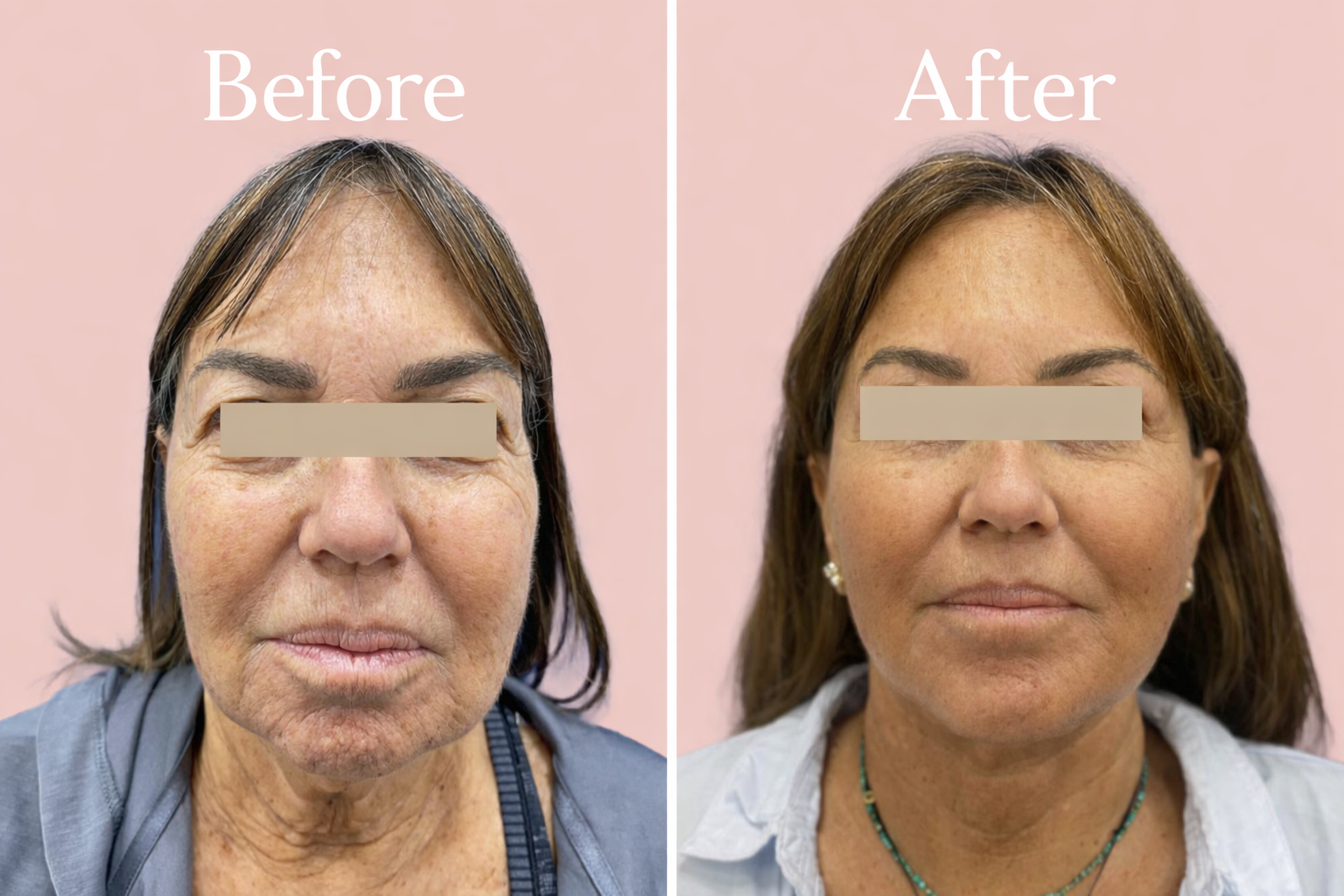 145c7060-2716-4563-b7b9-c8be44d00a27