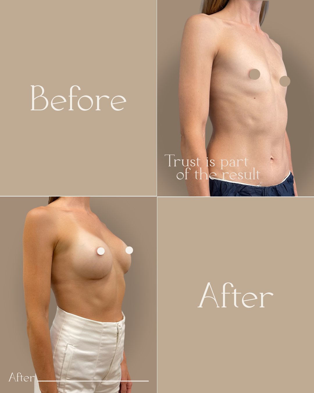 result_template_case3_fixed